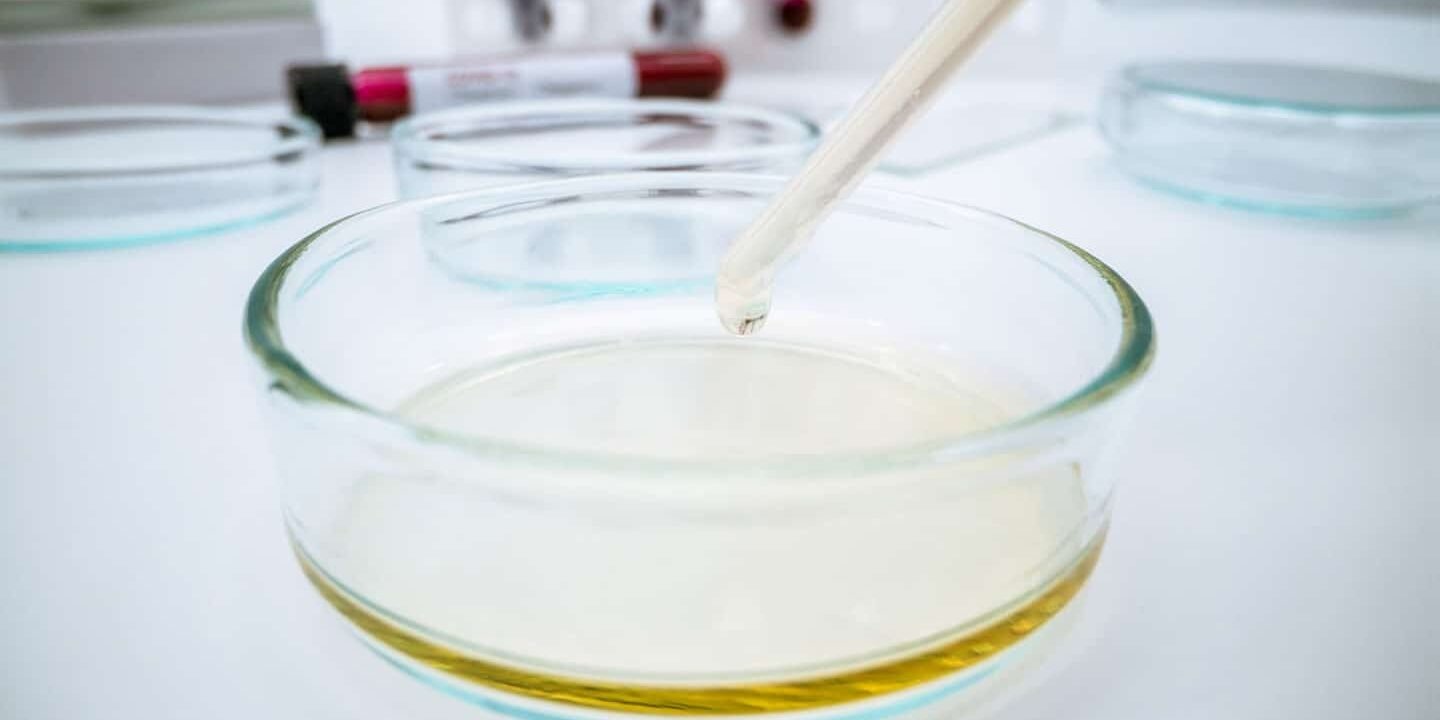 unlocking-yeast-cell-potential-in-biotechnology-the-role-of-homogenizers